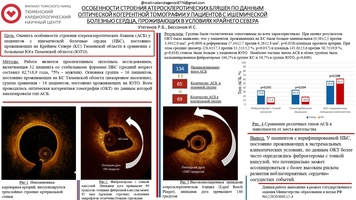 ОСОБЕННОСТИ СТРОЕНИЯ АТЕРОСКЛЕРОТИЧЕСКИХ БЛЯШЕК ПО ДАННЫМ 
ОПТИЧЕСКОЙ КОГЕРЕНТНОЙ ТОМОГРАФИИ У ПАЦИЕНТОВ С ИШЕМИЧЕСКОЙ 
БОЛЕЗНЬЮ СЕРДЦА, ПРОЖИВАЮЩИХ В УСЛОВИЯХ КРАЙНЕГО СЕВЕРА